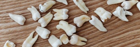 post op instructions tooth extraction